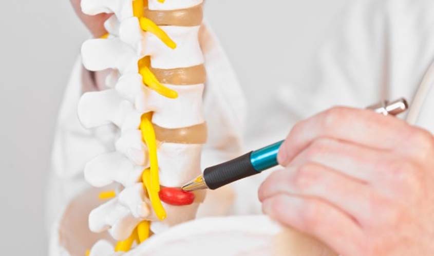 Dor no pescoço e na coluna pode ser causada por hérnia de disco?