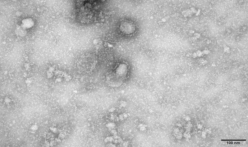 Governo cria grupo para monitorar casos de coronavirus