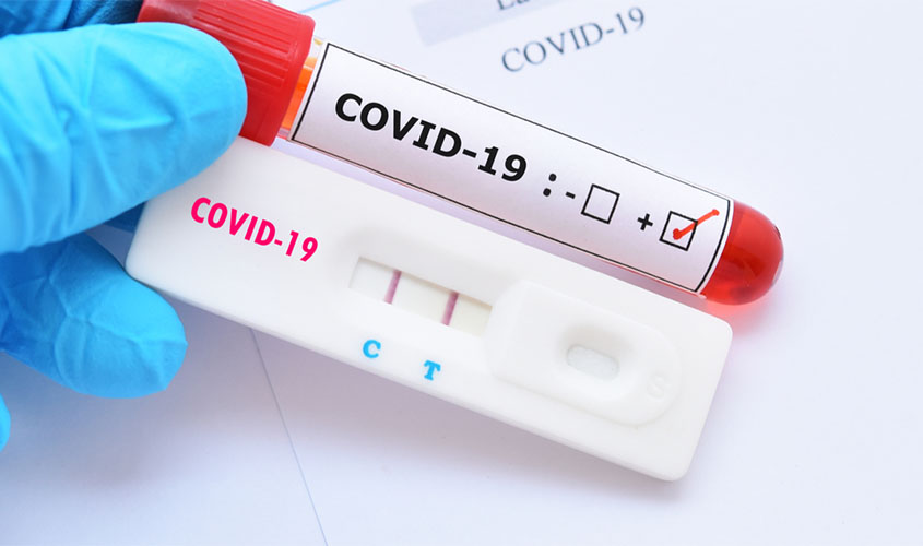 Covid-19: ANS torna obrigatória cobertura de teste por planos de saúde