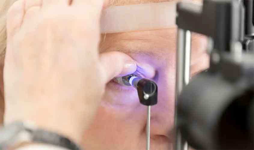 Saúde quer padronizar abordagem para eliminação do tracoma no Brasil